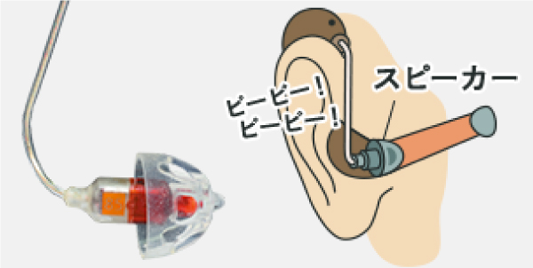 耳栓型補聴器